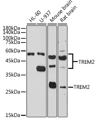 TREM2兔多抗,TREM2 Rabbit Polyclonal Antibody