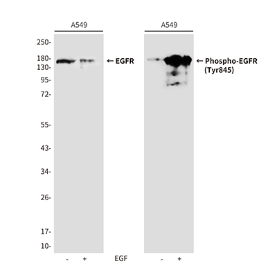 Phospho-EGFR (Tyr845)兔多抗,Phospho-EGFR (Tyr845) Rabbit Polyclonal Antibody