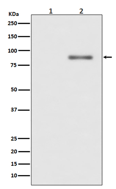 Phospho-PKC alpha (Thr638)兔多抗,Phospho-PKC alpha (Thr638) Rabbit Polyclonal Antibody