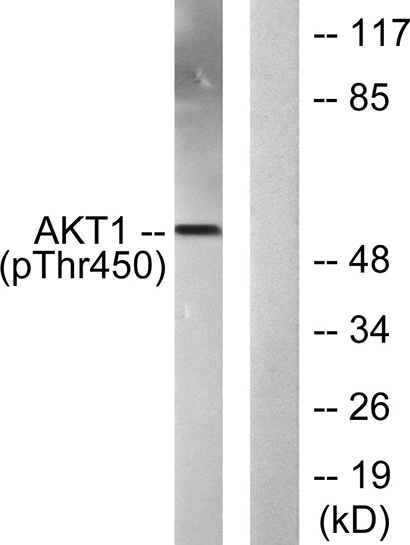 Akt1 (phospho Thr450)兔多抗,Akt1 (phospho Thr450) Rabbit Polyclonal Antibody
