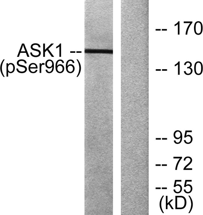 ASK 1 (phospho Ser966)兔多抗,ASK 1 (phospho Ser966) Rabbit Polyclonal Antibody