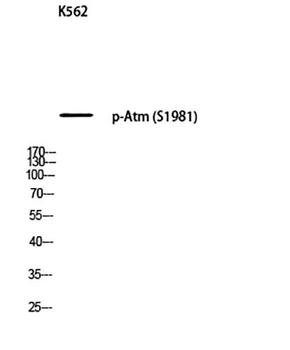 Atm (phospho Ser1981)兔多抗,Atm (phospho Ser1981) Rabbit Polyclonal Antibody