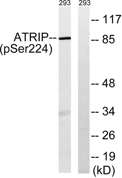ATRIP (phospho Ser224)兔多抗,ATRIP (phospho Ser224) Rabbit Polyclonal Antibody