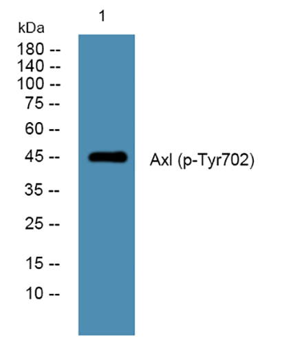 Axl (phospho-Tyr702) 兔多抗,Axl (phospho-Tyr702)  Rabbit Polyclonal Antibody