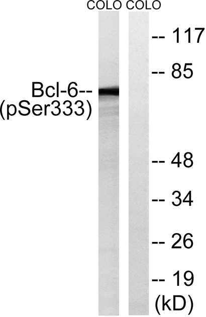 Bcl-6 (phospho Ser333)兔多抗,Bcl-6 (phospho Ser333) Rabbit Polyclonal Antibody