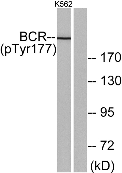Bcr (phospho Tyr177)兔多抗,Bcr (phospho Tyr177) Rabbit Polyclonal Antibody