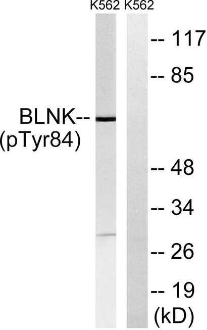 BLNK (phospho Tyr84)兔多抗,BLNK (phospho Tyr84) Rabbit Polyclonal Antibody