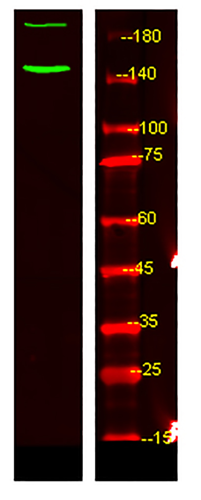 c-Abl (phospho-Tyr89) 兔多抗,c-Abl (phospho-Tyr89)  Rabbit Polyclonal Antibody