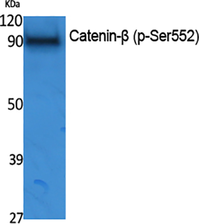 Catenin-β (phospho Ser552)兔多抗,Catenin-β (phospho Ser552) Rabbit Polyclonal Antibody