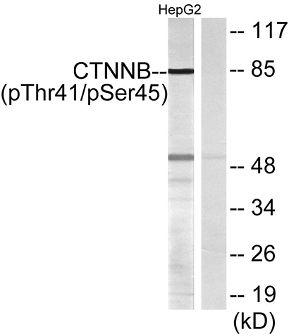 Catenin-β (phospho Thr41/S45)兔多抗,Catenin-β (phospho Thr41/S45) Rabbit Polyclonal Antibody