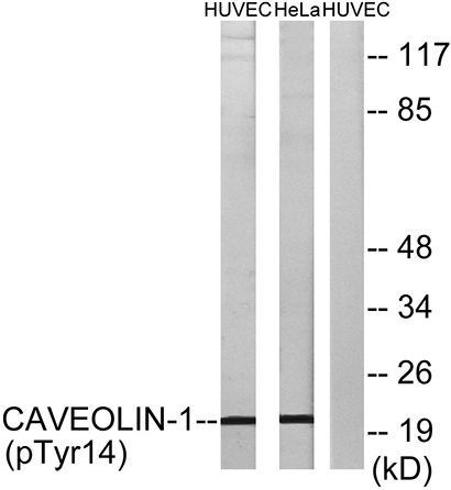 Caveolin-1 (phospho Tyr14)兔多抗,Caveolin-1 (phospho Tyr14) Rabbit Polyclonal Antibody