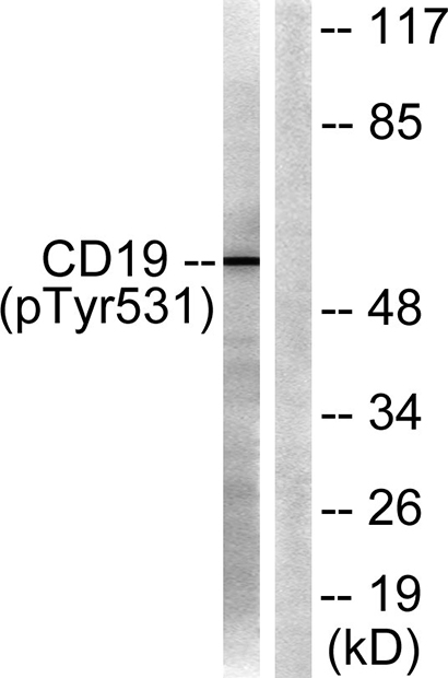 CD19 (phospho Tyr531)兔多抗,CD19 (phospho Tyr531) Rabbit Polyclonal Antibody