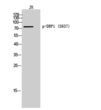DRP1 (phospho Ser637)兔多抗,DRP1 (phospho Ser637) Rabbit Polyclonal Antibody
