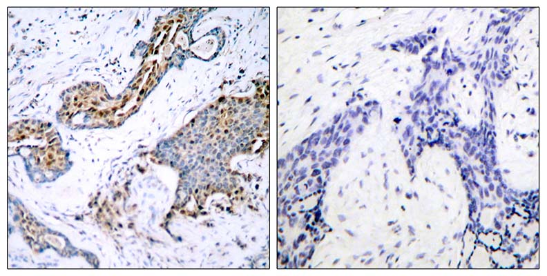 ERα (phospho Ser118)兔多抗,ERα (phospho Ser118) Rabbit Polyclonal Antibody