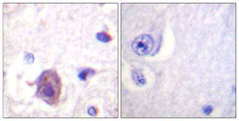 FAK (phospho Ser910)兔多抗,FAK (phospho Ser910) Rabbit Polyclonal Antibody