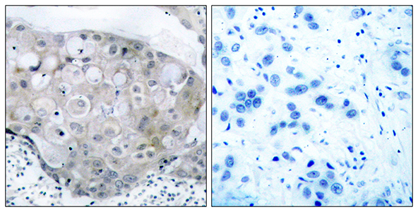 Flk-1 (phospho Tyr951)兔多抗,Flk-1 (phospho Tyr951) Rabbit Polyclonal Antibody
