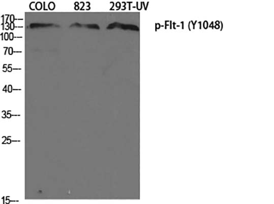 Flt-1 (phospho Tyr1048)兔多抗,Flt-1 (phospho Tyr1048) Rabbit Polyclonal Antibody