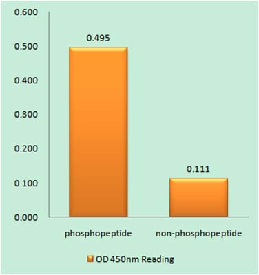 Glycogen Synthase 1 (phospho Ser645)兔多抗,Glycogen Synthase 1 (phospho Ser645) Rabbit Polyclonal Antibody