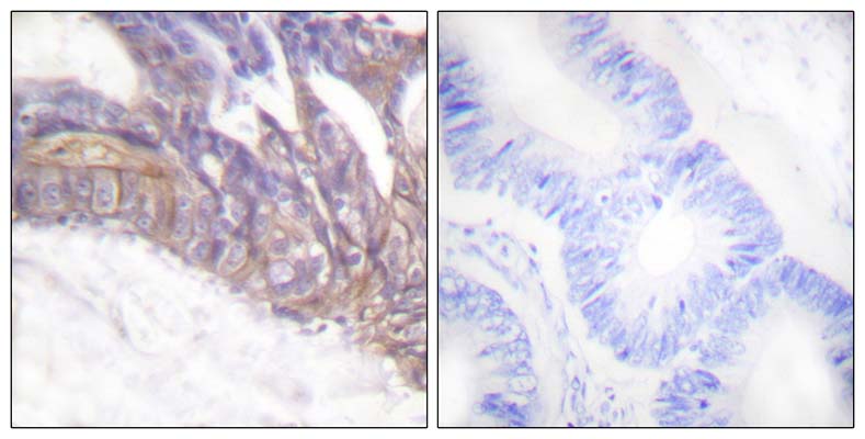 LAT (phospho Tyr191)兔多抗,LAT (phospho Tyr191) Rabbit Polyclonal Antibody
