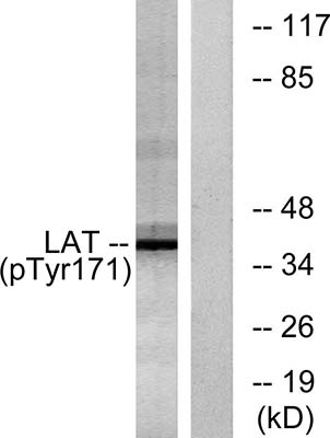 LAT (phospho Tyr200)兔多抗,LAT (phospho Tyr200) Rabbit Polyclonal Antibody