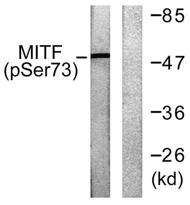 MITF (phospho Ser180)兔多抗,MITF (phospho Ser180) Rabbit Polyclonal Antibody