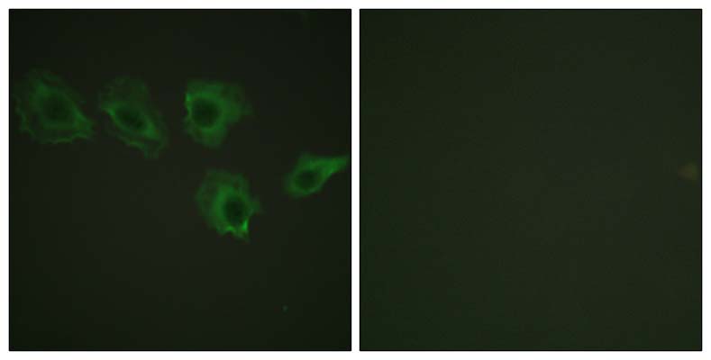 MYPT1 (phospho Thr696)兔多抗,MYPT1 (phospho Thr696) Rabbit Polyclonal Antibody