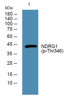 NDRG1 (phospho-Thr346) 兔多抗,NDRG1 (phospho-Thr346)  Rabbit Polyclonal Antibody