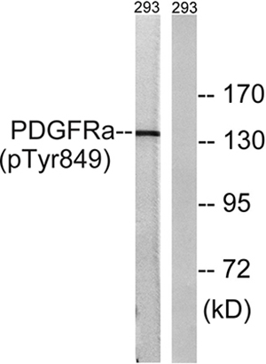 PDGFR-α (phospho Tyr849)兔多抗,PDGFR-α (phospho Tyr849) Rabbit Polyclonal Antibody