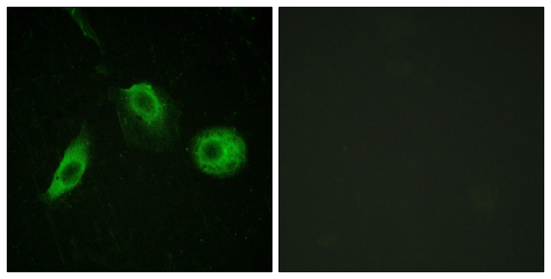 PLC γ2 (phospho Tyr1217)兔多抗,PLC γ2 (phospho Tyr1217) Rabbit Polyclonal Antibody