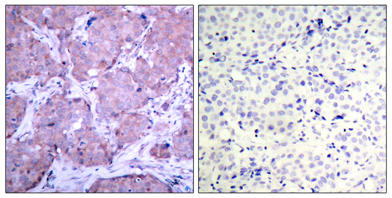 PTEN (phospho Ser380)兔多抗,PTEN (phospho Ser380) Rabbit Polyclonal Antibody
