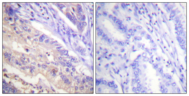 PTEN (phospho Ser385)兔多抗,PTEN (phospho Ser385) Rabbit Polyclonal Antibody