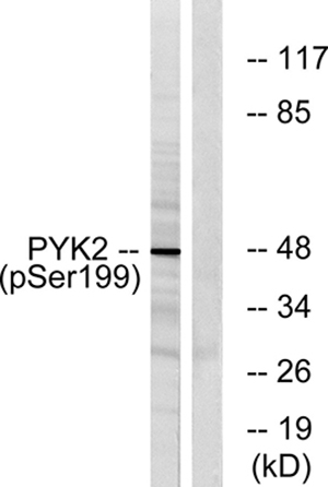 PYK2 (phospho Tyr402)兔多抗,PYK2 (phospho Tyr402) Rabbit Polyclonal Antibody