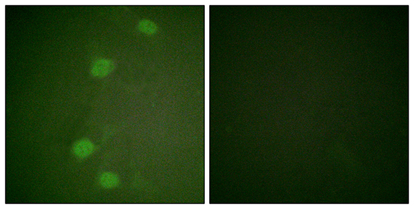 Rb (phospho Ser249)兔多抗,Rb (phospho Ser249) Rabbit Polyclonal Antibody