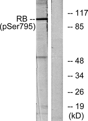 Rb (phospho Ser795)兔多抗,Rb (phospho Ser795) Rabbit Polyclonal Antibody