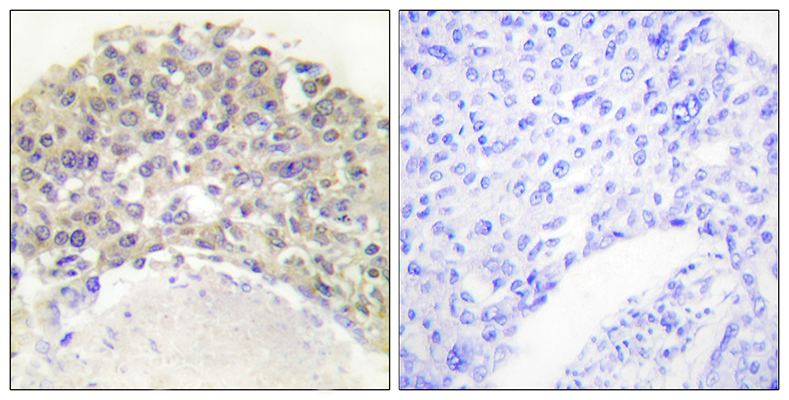 Shc (phospho Tyr349)兔多抗,Shc (phospho Tyr349) Rabbit Polyclonal Antibody