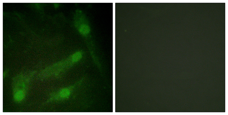 Smad2 (phospho Thr220)兔多抗,Smad2 (phospho Thr220) Rabbit Polyclonal Antibody