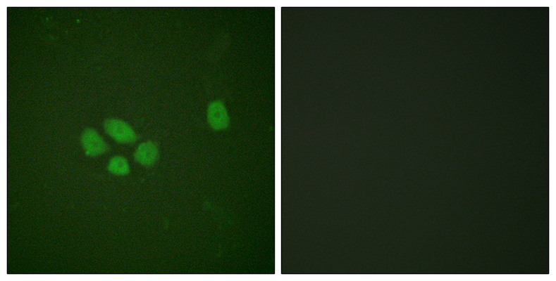 Sox-9 (phospho Ser181)兔多抗,Sox-9 (phospho Ser181) Rabbit Polyclonal Antibody
