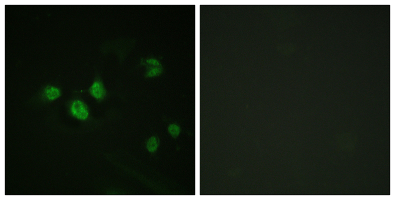 Sp1 (phospho Thr453)兔多抗,Sp1 (phospho Thr453) Rabbit Polyclonal Antibody