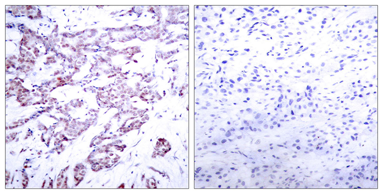Stat6 (phospho Thr645)兔多抗,Stat6 (phospho Thr645) Rabbit Polyclonal Antibody