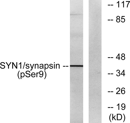Synapsin I (phospho Ser9)兔多抗,Synapsin I (phospho Ser9) Rabbit Polyclonal Antibody