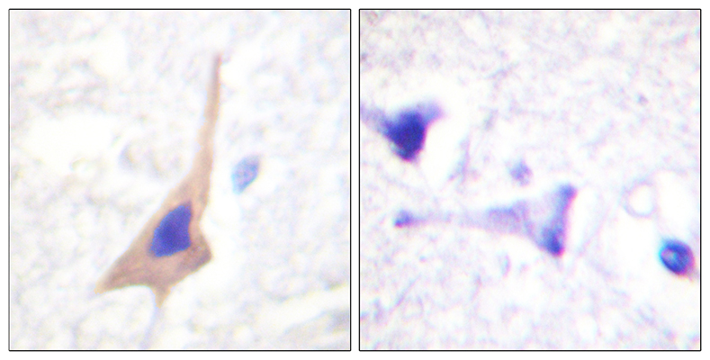 TPH1 (phospho Ser58)兔多抗,TPH1 (phospho Ser58) Rabbit Polyclonal Antibody