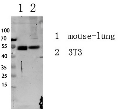 Smad3 (Phospho-Ser213)兔多抗,Smad3 (Phospho-Ser213) Rabbit Polyclonal Antibody