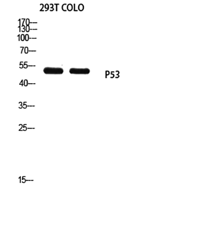 p53 (Mono Methyl Lys370)兔多抗,p53 (Mono Methyl Lys370) Rabbit Polyclonal Antibody