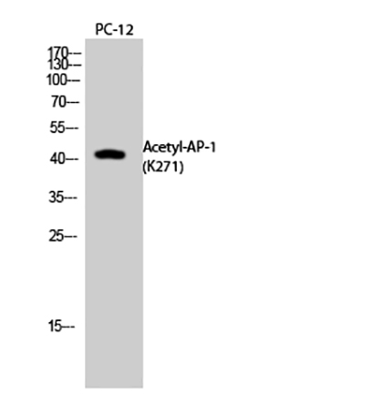 AP-1 (Acetyl Lys271)兔多抗,AP-1 (Acetyl Lys271) Rabbit Polyclonal Antibody