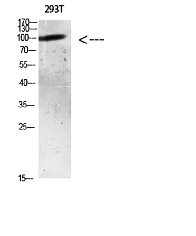 AR (Acetyl Lys633)兔多抗,AR (Acetyl Lys633) Rabbit Polyclonal Antibody