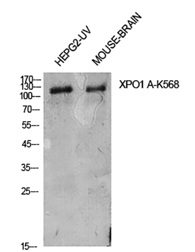 CRM1 (Acetyl Lys568)兔多抗,CRM1 (Acetyl Lys568) Rabbit Polyclonal Antibody