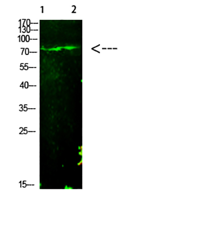 E2F-1 (Acetyl-K125)兔多抗,E2F-1 (Acetyl-K125) Rabbit Polyclonal Antibody