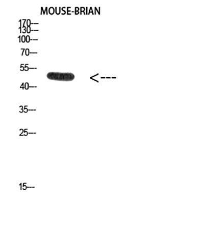 E2F-1 (Acetyl-Lys120)兔多抗,E2F-1 (Acetyl-Lys120) Rabbit Polyclonal Antibody