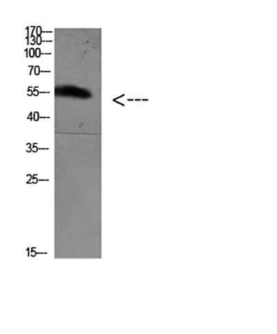 FoxO4 (Acetyl Lys189)兔多抗,FoxO4 (Acetyl Lys189) Rabbit Polyclonal Antibody