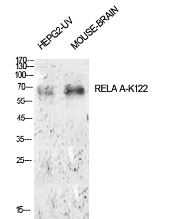 NFκB-p65 (Acetyl Lys122)兔多抗,NFκB-p65 (Acetyl Lys122) Rabbit Polyclonal Antibody